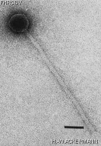 HER283 Image of phage under microscope