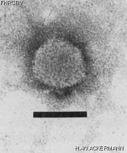 HER284 Image of phage under microscope