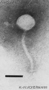 HER286 Image of phage under microscope