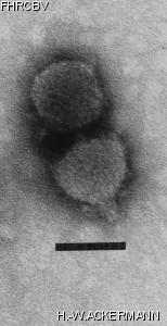 HER287 Image of phage under microscope