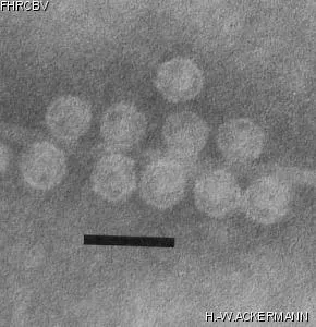 HER290 Image of phage under microscope