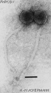 HER293 Image of phage under microscope