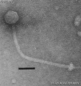 Image of phage under microscope