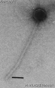 HER295 Image of phage under microscope