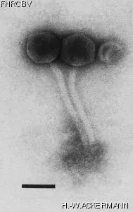 HER296 Image of phage under microscope