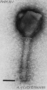 HER3 Image of phage under microscope