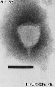 HER30 Image of phage under microscope
