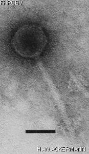 HER305 Image of phage under microscope