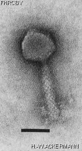HER306 Image of phage under microscope
