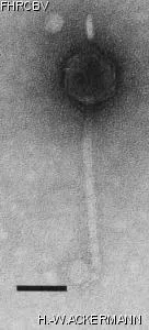 HER312 Image of phage under microscope