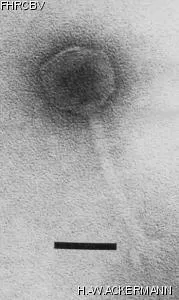 HER313 Image of phage under microscope