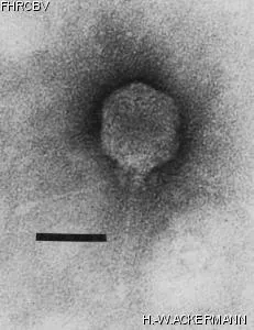 HER315 Image of phage under microscope