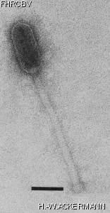 HER316 Image of phage under microscope