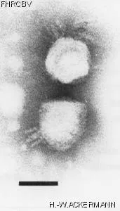 HER321 Image of phage under microscope