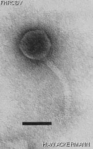 HER323 Image of phage under microscope