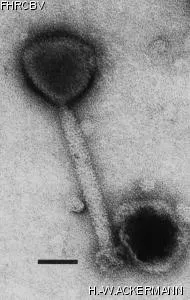 HER325 Image of phage under microscope