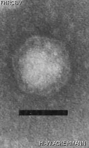 HER326 Image of phage under microscope