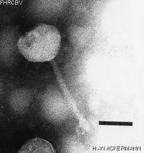 HER328 Image of phage under microscope