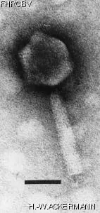 HER33 Image of phage under microscope