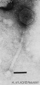HER331 Image of phage under microscope