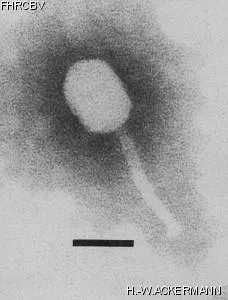 HER338 Image of phage under microscope