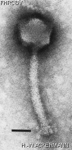 HER339 Image of phage under microscope