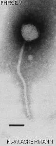 HER34 Image of phage under microscope