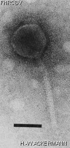 HER340 Image of phage under microscope