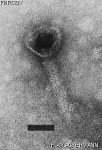 HER341 Image of phage under microscope