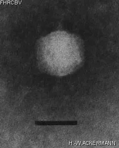 HER342 Image of phage under microscope