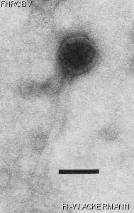 HER344 Image of phage under microscope