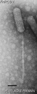 HER346 Image of phage under microscope