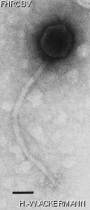 HER347 Image of phage under microscope