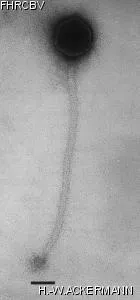HER348 Image of phage under microscope