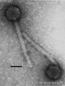 HER35 Image of phage under microscope