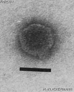 HER353 Image of phage under microscope