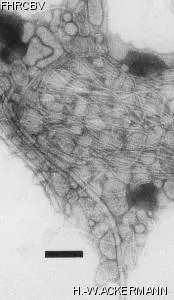 HER354 Image of phage under microscope