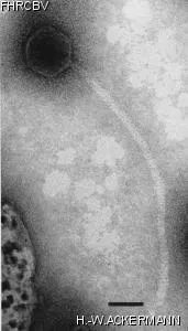 HER358 Image of phage under microscope
