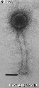 HER361 Image of phage under microscope