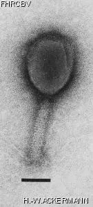 HER366 Image of phage under microscope