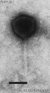 HER367 Image of phage under microscope