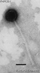 HER368 Image of phage under microscope