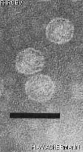 Image of phage under microscope