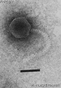 HER370 Image of phage under microscope
