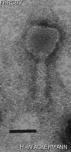 HER373 Image of phage under microscope