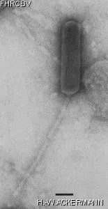HER377 Image of phage under microscope