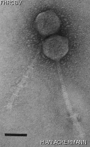 Image of phage under microscope