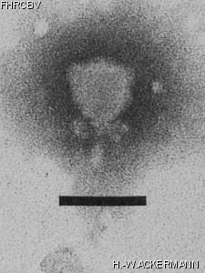 HER381 Image of phage under microscope