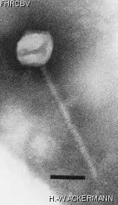Image of phage under microscope