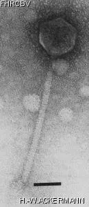 HER384 Image of phage under microscope